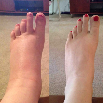Lymphatic Drainage Drops™